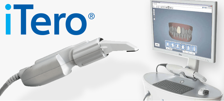 Itero scanner