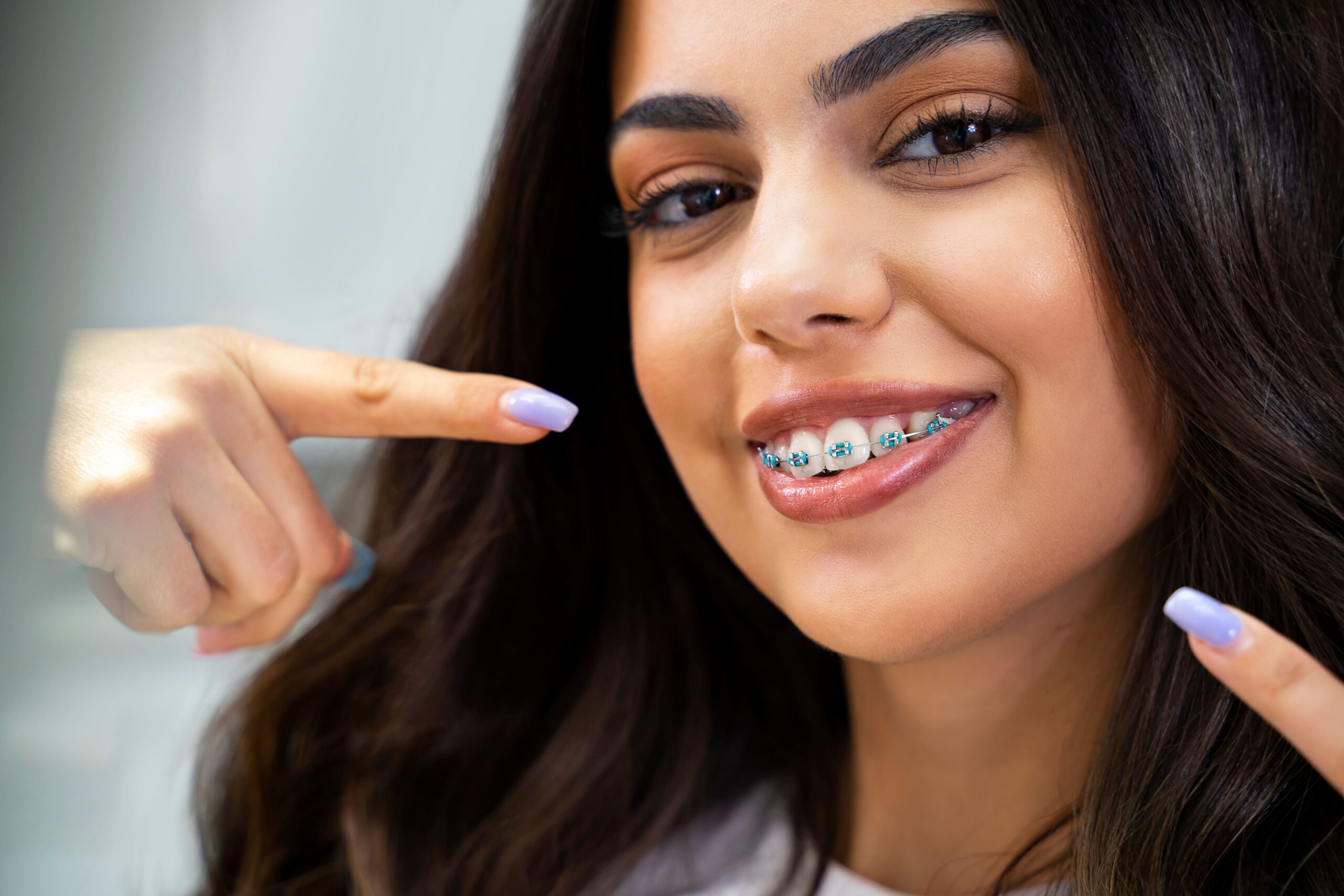 braces in Concord NH